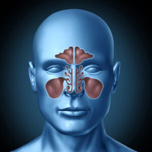 sinus surgery