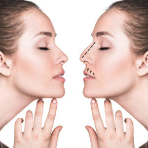 setoplasty